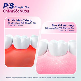 Bàn chải P/S Chuyên gia chăm sóc nướu
