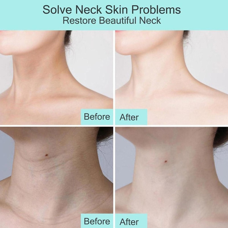 1 Mặt Nạ Sữa Dê Collagen Chống Nếp Nhăn Lão Hóa Dưỡng Ẩm Làm Săn Chắc Da Vùng Cổ