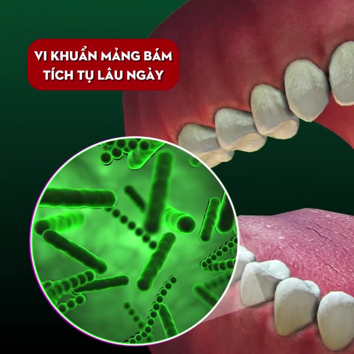 Nước Súc Miệng Chuẩn Y Khoa DrKam 250ml Khử Hôi Miệng Giảm Viêm Nướu Ê Buốt - Không Cồn Không Cay
