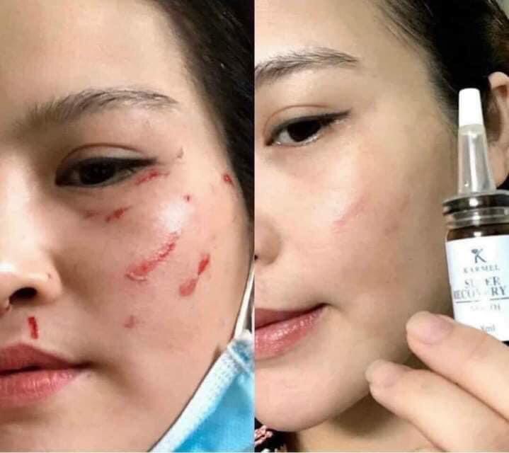 Ảnh đánh giá
