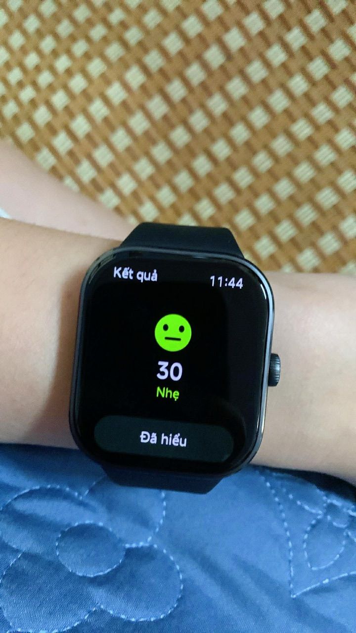 Các lựa chọn Redmi Watch