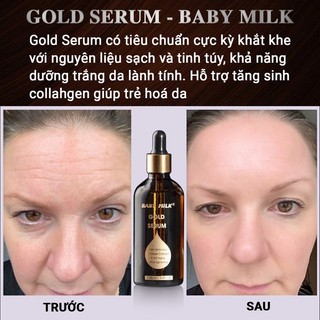 Serum Dưỡng Trắng Ngăn Ngừa Nám Mụn Gold Serum - Baby Milk 100ml - Hàng Hiệu Cao Thiên Nhi
