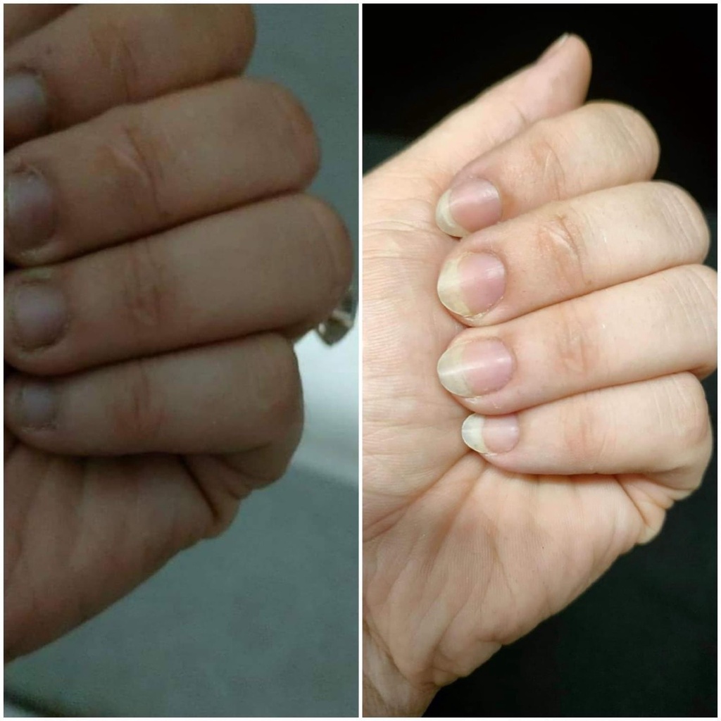 [FREESHIP Toàn Quốc] Dưỡng Móng Cứng Phục Hồi Móng Tay Chân Chắc Khỏe, Nhanh Dài, Bóng Hũ 8gr