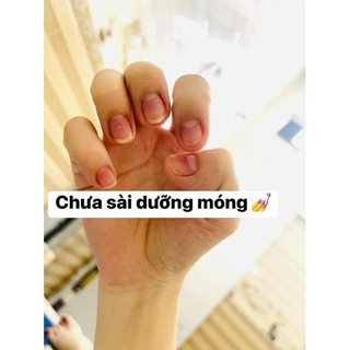 Combo Sỉ 50 Dưỡng Móng Độc Quyền Thiên Di Giúp Móng Hồng Bóng Khoẻ Nhanh dài