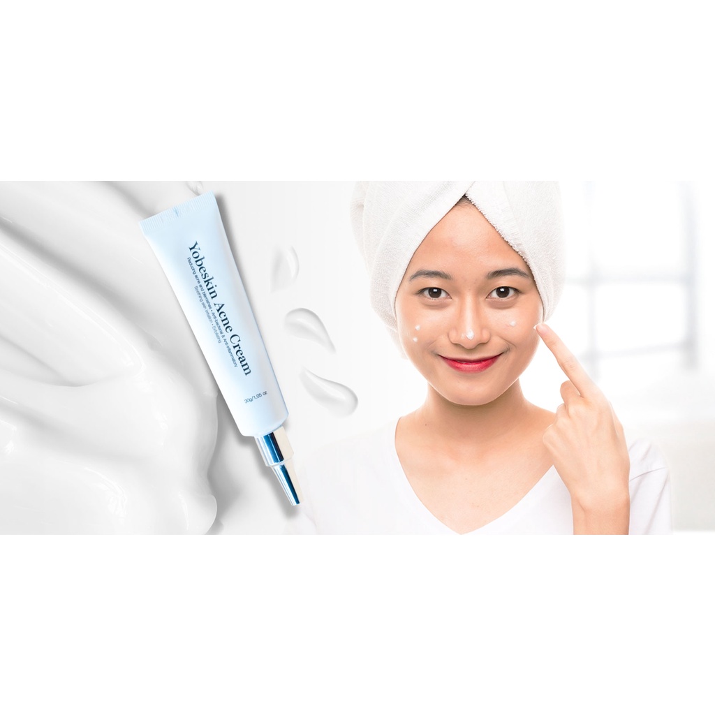 Kem Ngăn Ngừa Mụn Và Thâm Yobe - Yobeskin Acne Cream [Chính Hãng]