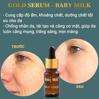 [Mới] Serum Dưỡng Trắng Ngăn Ngừa Nám Mụn Gold Serum - Baby Milk 10ml - Hàng Hiệu Cao Thiên Nhi
