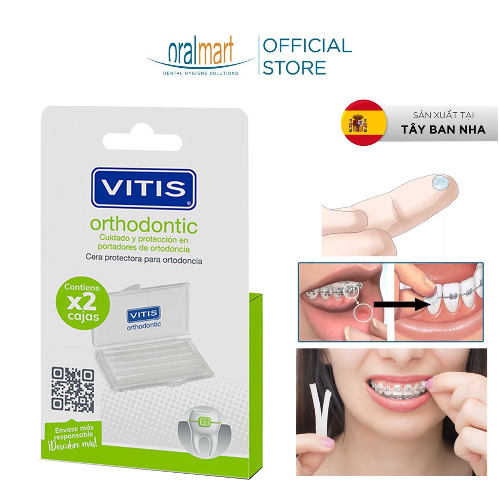 Sáp nha khoa Vitis Orthodontic Wax – Giảm khó chịu khi niềng răng (Vỉ 2 ...