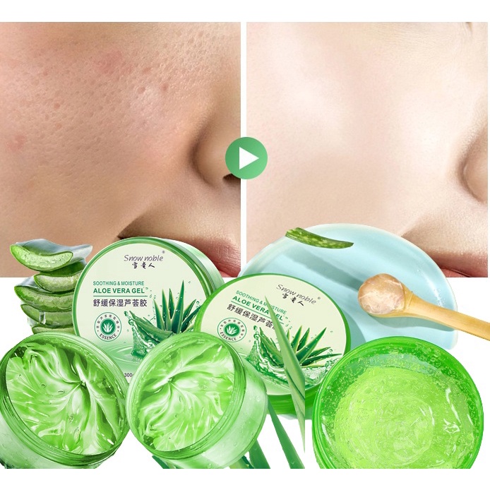 Chất lượng Tuýp Tiêu Chuẩn