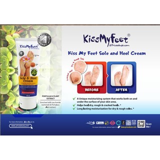 Kem Ngăn Ngừa Nứt Nẻ Gót Chân KISS MY FEET 100ML I Dưỡng Ẩm, Giảm Chai Sần, Khô Gót Chân - ( Vivan _ Cosmetics )