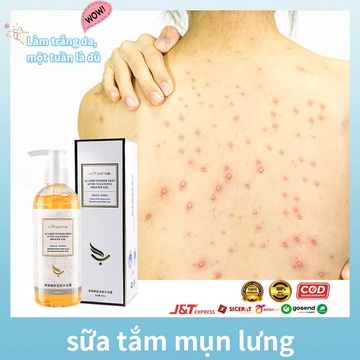 HYQING Sữa tắm chống ve Sữa tắm loại bỏ mụn sữa tắm trắng da 260ml giúp giải quyết tình trạng da khô ngứa kháng khuẩn khử mùi hôi Làm sạch sâu bụi bẩn dưới da Cải thiện mụn trứn