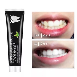 Kem đánh làm trắng răng than tre BAMBOO CHARCOAL TOOTHPASTE .khử mùi hôi,kháng khuẩn, tẩy ố vàng, giảm sâu răng...