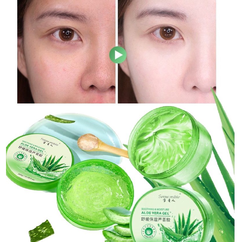 Gel Nha Đam Dạng Tuýp - Hình ảnh thực tế