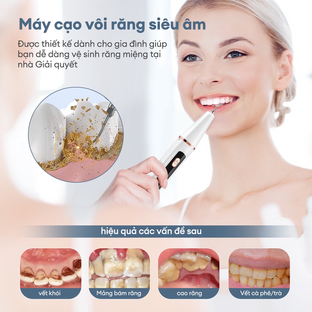 Ảnh Máy lấy cao răng CKEYIN KQ158W loại bỏ vi khuẩn/vết ố/làm sạch răng nướu kèm 2 đầu làm sạch thay thế tại nhà 2