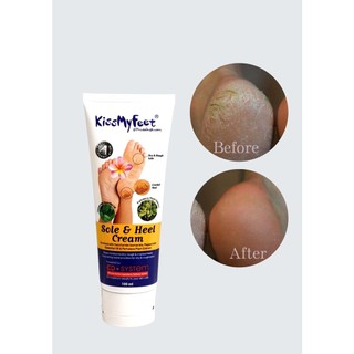 Kem Ngăn Ngừa Nứt Nẻ Gót Chân KISS MY FEET 100ML I Dưỡng Ẩm, Giảm Chai Sần, Khô Gót Chân - ( Vivan _ Cosmetics )