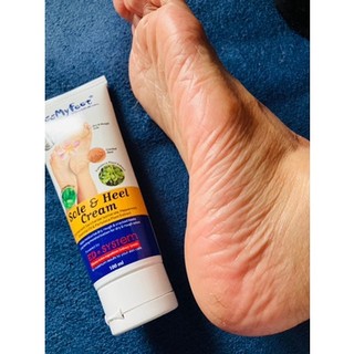 Kem Ngăn Ngừa Nứt Nẻ Gót Chân KISS MY FEET 100ML I Dưỡng Ẩm, Giảm Chai Sần, Khô Gót Chân - ( Vivan _ Cosmetics )