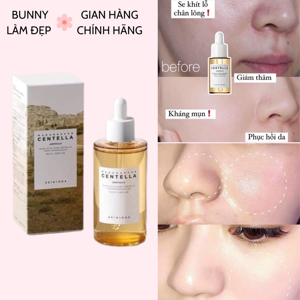 (CHÍNH HÃNG) Serum Centella Rau Má 55ml-100ml , Tinh chất rau má ...
