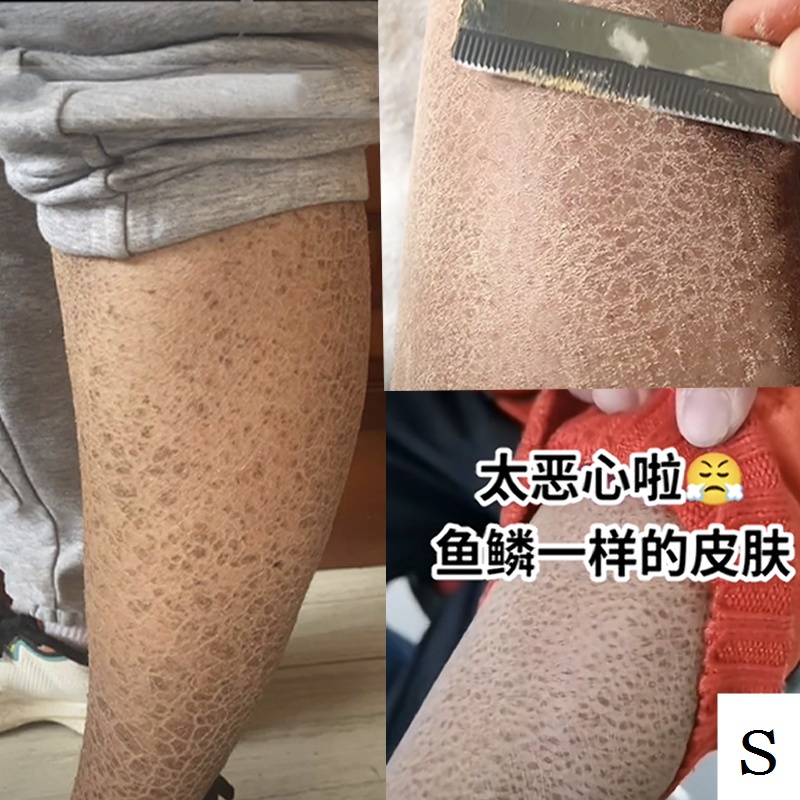 Kem Dưỡng Ẩm Làm Trắng Da Toàn Thân 100% Thành Phần Vảy Cá / Da Rắn ...