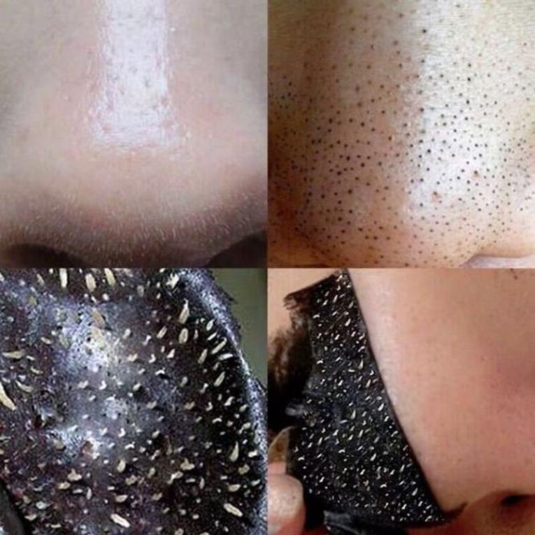 Gel lột mụn đầu đen.hoat tính than. hiệu quả ngay lần đầu sử dụng.làm sạch lổ chân lông.sử dụng 1 tuần 2 lần