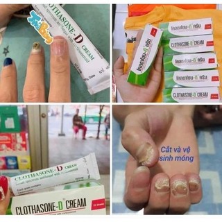 Kem bôi nấm móng  Kem Dưỡng Móng Nail Care CLOTHASONE-D CREAM 15g