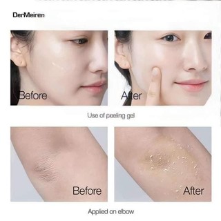 Tẩy Da Chết Pretty Skin The Pure Jeju Cica Peeling Gel 150ml Rau Má Nhẹ Dịu Dạng Gel - Bebeau