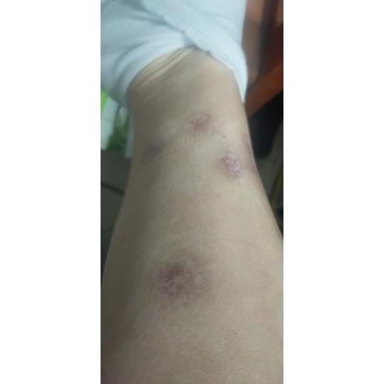 scar_esthetique_4ml Kem sẹo rejuvaskin Hàng Mỹ