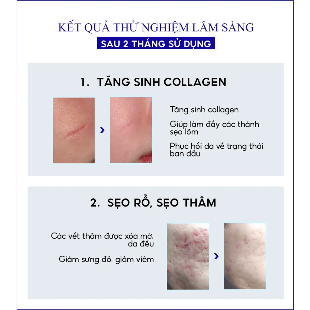 scar_esthetique_4ml Kem sẹo rejuvaskin Hàng Mỹ