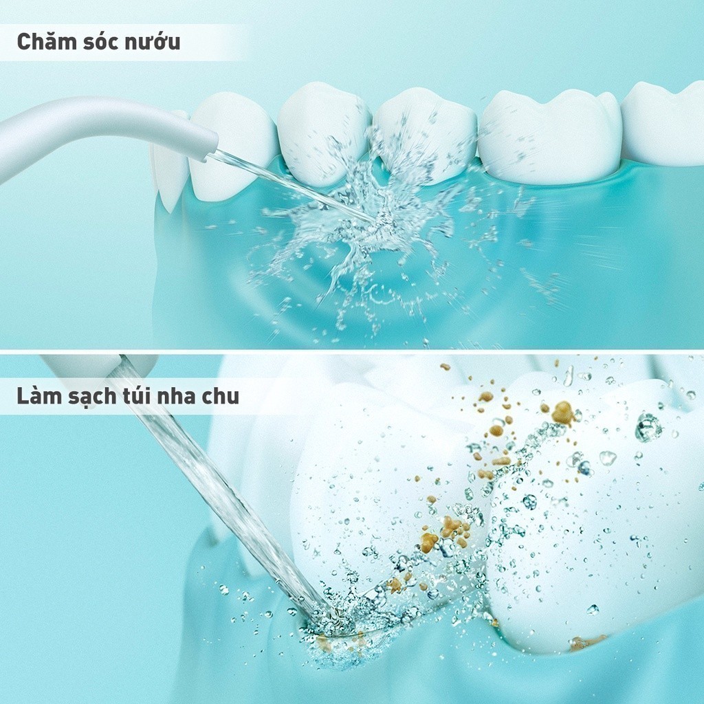 Đầu Tăm nước Thay Thế Panasonic WEW0987W451 – Phụ kiện cho máy tăm nước  EW-DJ11 và EW-DJ31 | Shopee Việt Nam