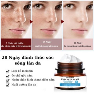 Kem bôi nám tàn nhang FRECKLE CREAM Kem xóa nám mờ nám tàn nhang đồi mồi chống lão hoá TP06