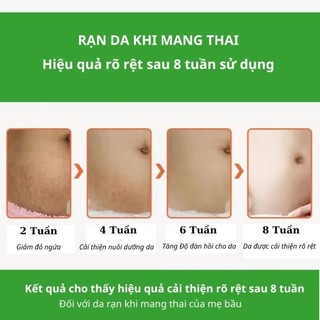 Kem rạn da SNMLPM hỗ trợ giảm sẹo sau sinh Kem dạn da sau sinh làm trắng và săn chắc mịn màng TP07
