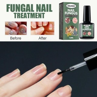 Serum nấm móng tay chân EELHOE 15ml dưỡng cứng hết sạch nấm bọng móng hư khoé nước TP14