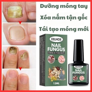 Serum nấm móng tay chân EELHOE 15ml dưỡng cứng hết sạch nấm bọng móng hư khoé nước TP14