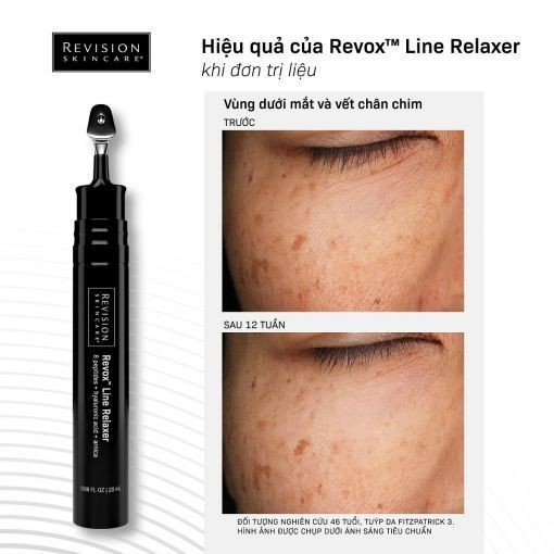 Serum xoá nhăn toàn diện Revision Skincare REVOX LINE RELAXER 20mL
