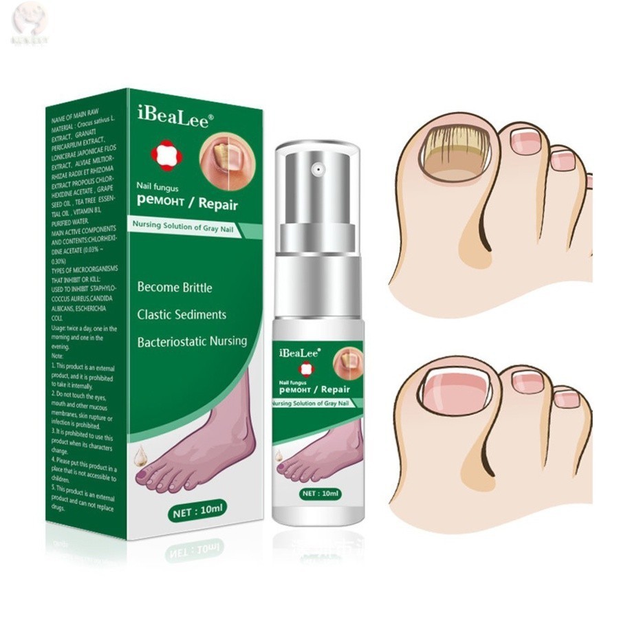 Xịt nấm móng tay chân iBeaLee 10ml Serum ngừa nấm móng tay chân dưỡng móng kháng khuẩn H07