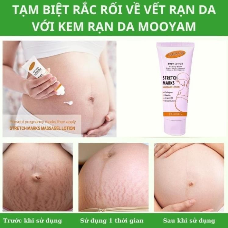 Kem bôi rạn da giảm sẹo sau sinh SNMLPM Kem dạn da sau sinh làm trắng săn chắc mịn màng H04