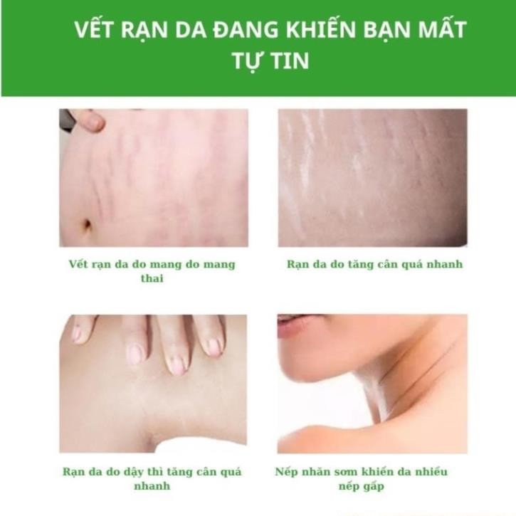 Kem bôi rạn da giảm sẹo sau sinh SNMLPM Kem dạn da sau sinh làm trắng săn chắc mịn màng H04