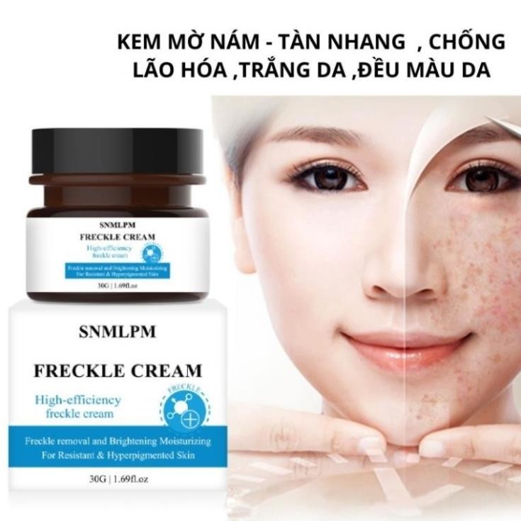 Kem bôi nám tàn nhang FRECKLE CREAM xóa mờ vết thâm nám tàn nhang đồi mồi chống lão hoá H03