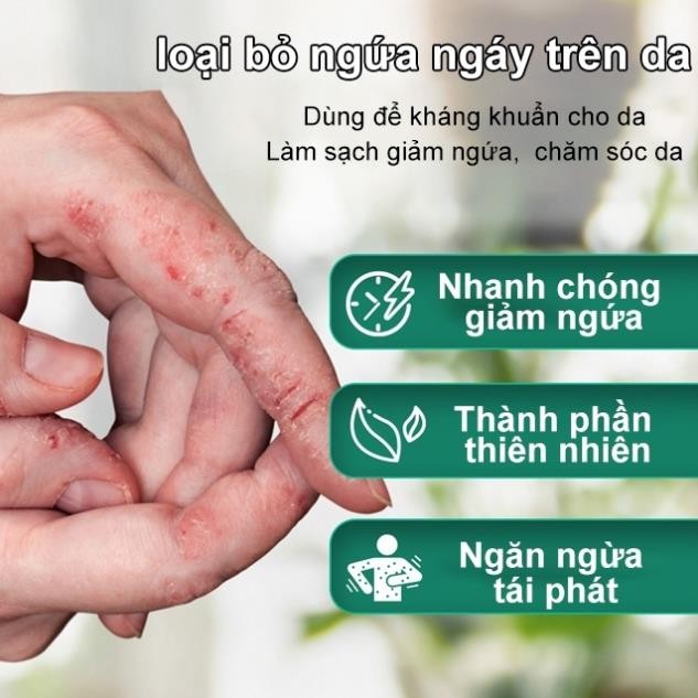Kem viêm da cơ địa Nội địa Trung 30g hết ngứa tái tạo da Kem bôi nứt nẻ gót chân an toàn H13