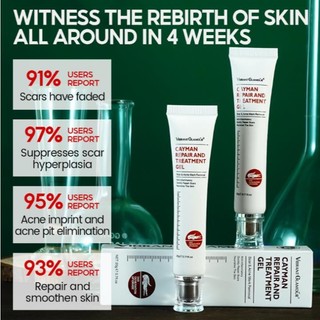 Kem mờ sẹo Vibrant 20g làm mờ sẹo lâu năm loại bỏ sẹo mụn sẹo lồi lõm rạn da sau sinh