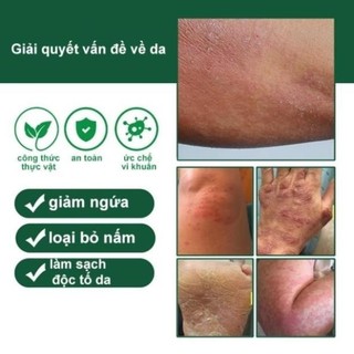 Kem viêm da cơ địa Nội địa Trung 30g tái tạo da hết ngứa Kem bôi nấm ngứa da nứt nẻ gót chân