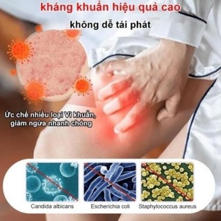 Kem viêm da cơ địa Nội địa Trung 30g tái tạo da hết ngứa Kem bôi nấm ngứa da nứt nẻ gót chân