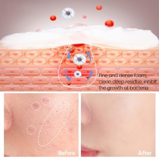 Xà phòng đen VIBRANT 100g làm sạch mụn đầu đen trứng cá Xà bông ngừa mụn lưng hết thâm