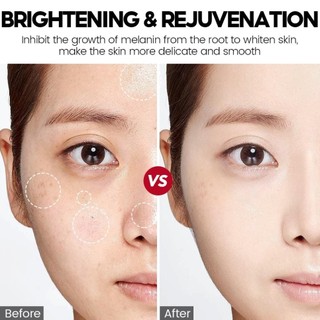 Xà phòng làm trắng ngừa mụn VIBRANT 100g Xà bông tẩy tế bào chết làm sạch sâu sáng da trẻ hóa