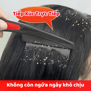 Lược Chải Chấy Lược Chải Chí Lược Chải Gàu Thép Không Gỉ Lược Bí Siêu Bền Không Đau Không Gãy Life Plus - LCT01