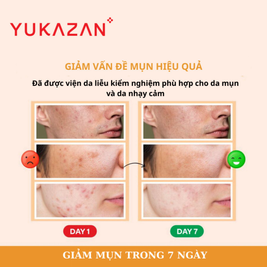 Ảnh Kem Giảm Mụn, Giảm Viêm Yukazan Refining Cream 5ml - Công Thức Thảo Mộc Japan Murasaki 2