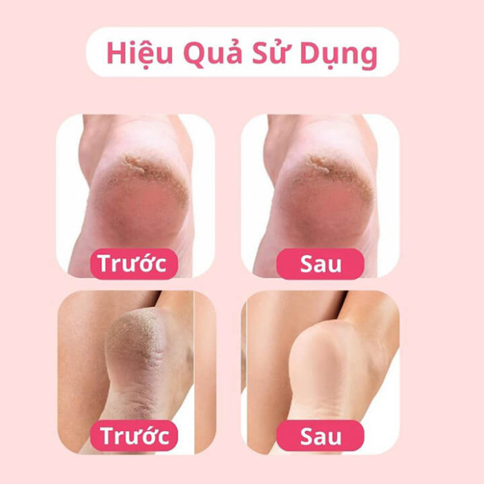 Máy chà gót chân tẩy tế bào chết tự động, máy mài gót chân tích điện cho tiệm nail spa, chăm sóc da tại nhà 2 đầu mài