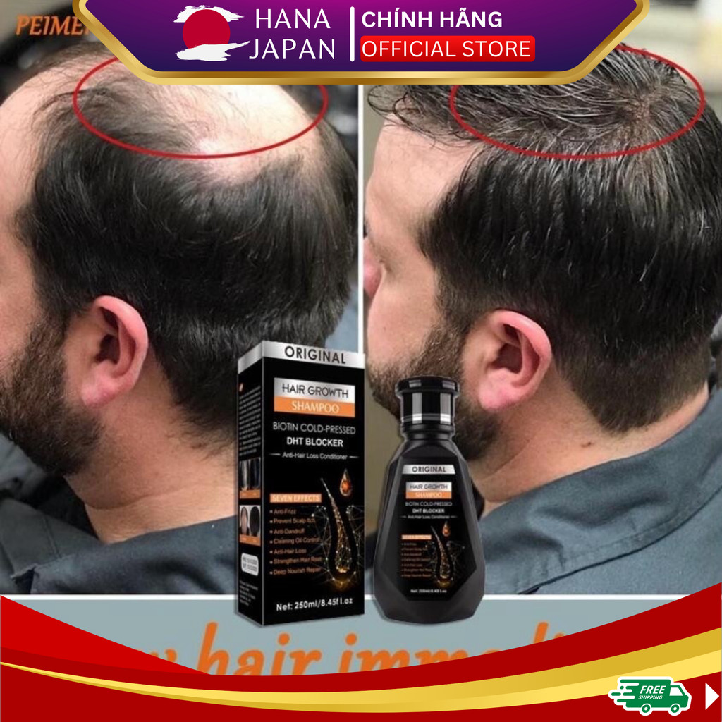 Combo Dầu gội + Serum mọc tóc giảm gàu DHT - Dầu gội DHT kích thích mọc tóc, giảm gàu, nấm ngứa, bảo vê nang tóc chắc k