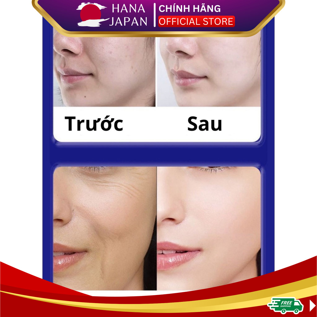 [COMBO 5 TUÝP - GIÁ SỈ] Kem Giảm Nám UCM Japan 20g Chống Nhăn Và Trẻ Hóa Da - Chính Hãng