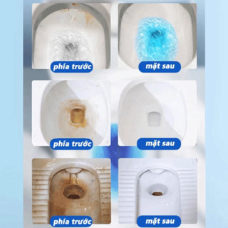 Cốc Thả Bồn Cầu Viên Tẩy Bồn Cầu Loại Bỏ Mảng Bám, Khử Mùi Hôi, Diệt Vi Khuẩn 99,9% Dùng 1 Tháng NGÓI HOME - TBC03