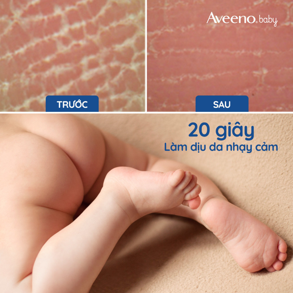 Ảnh Sữa dưỡng thể hàng ngày Aveeno Baby Daily Moisture Lotion 227g 4
