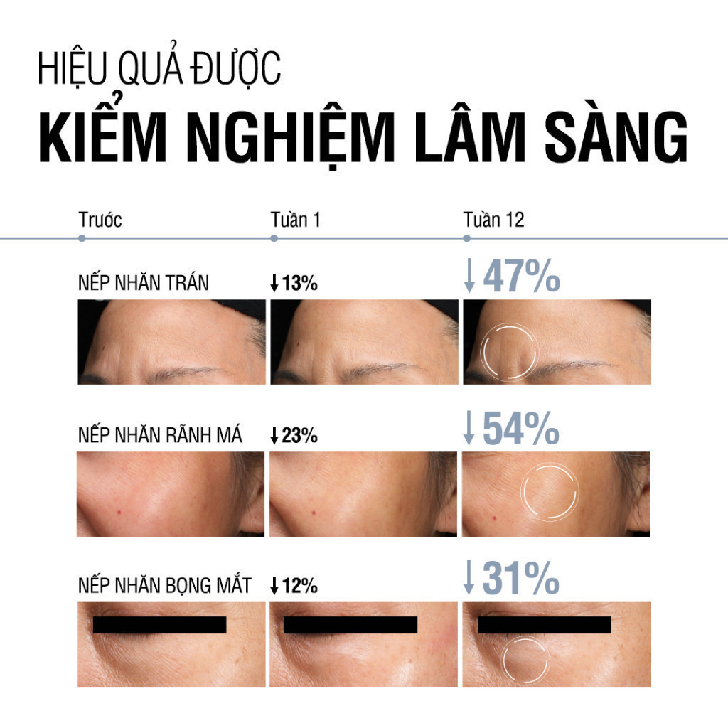 Ảnh Kem dưỡng Retinol Chống Lão Hóa Giảm Nhăn Neutrogena Visible Repair Regenerating Cream (50g) 4